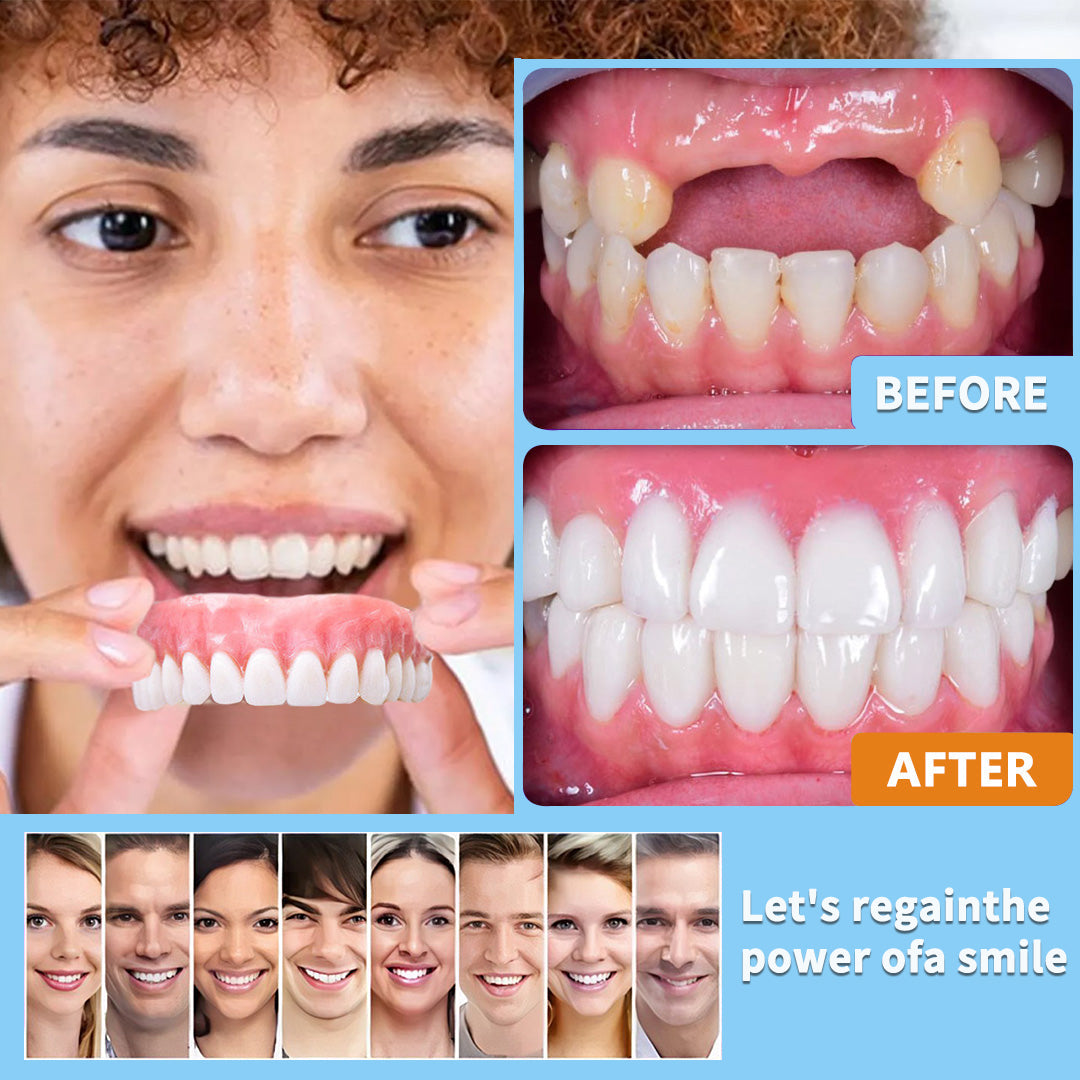 Flexible Denture Set for Upper & Lower Jaw – Reusable & Custom-Fit — photo 12