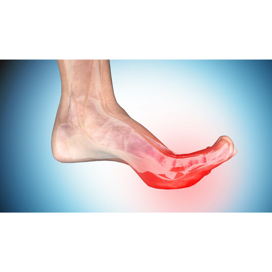 5 Proven Methods to Get Rid of Constant Foot Cramps