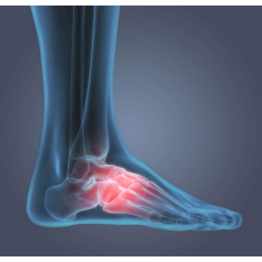 7 Most Likely Causes of Pain in the Foot Arch