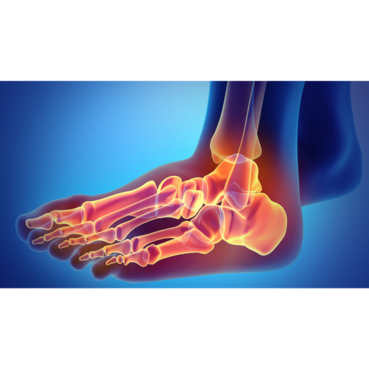 "How I successfully relieved the arthritis pain in my feet"