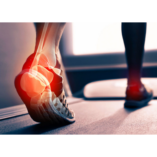 Should You Undergo Surgery For Plantar Fasciitis?