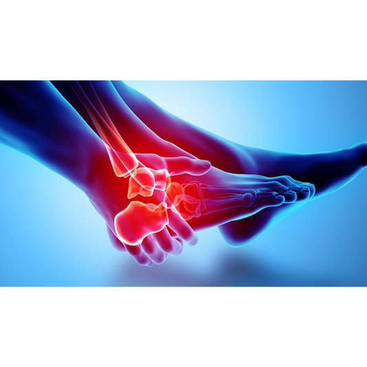 Foot Problems: The Complete Guide to Diagnosing Foot &amp; Heel Pain