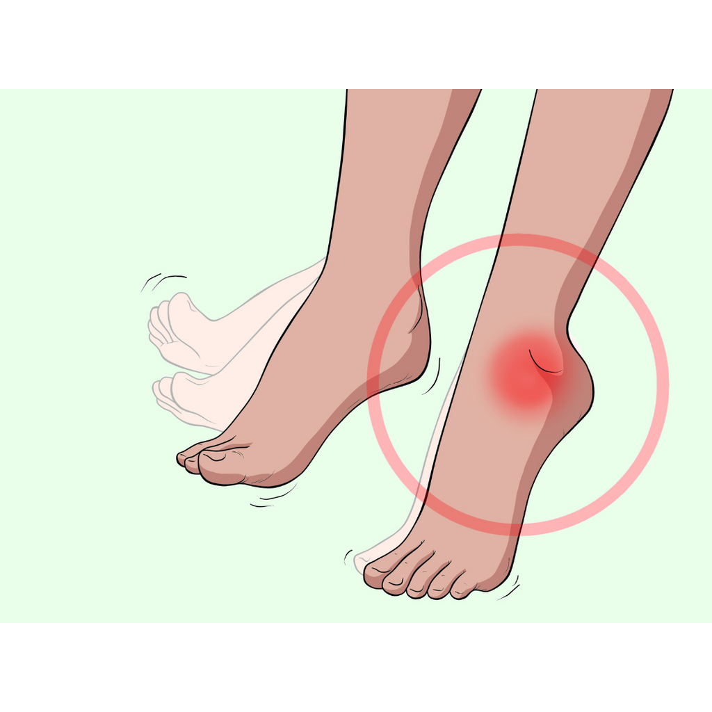 The Ultimate Guide to Foot Drop: Learn What Causes Drop Foot and What You Can Do to Treat It