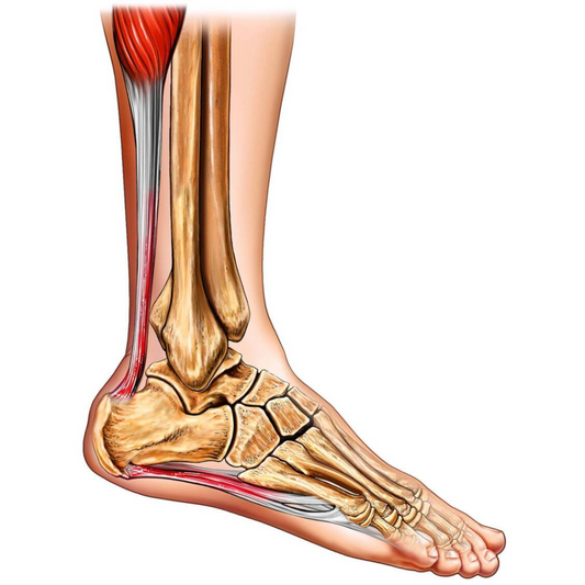 The Best Plantar Fasciitis Treatments