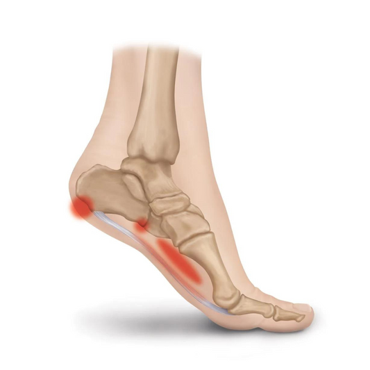 10 exercises for plantar fasciitis