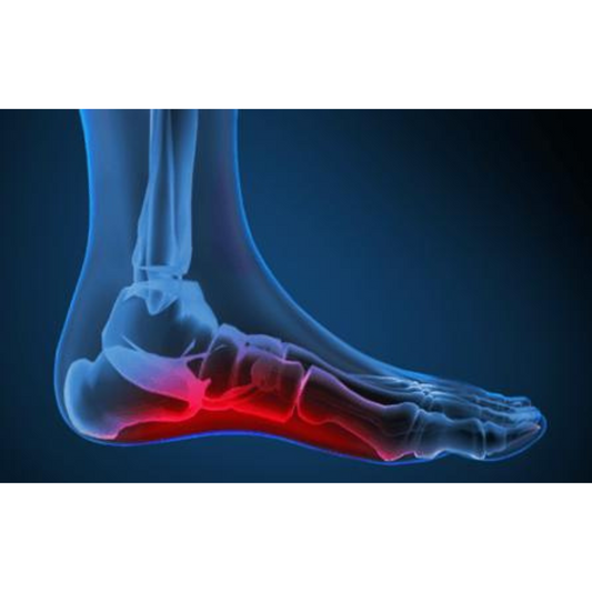 Flat Feet Symptoms, Causes, and How to Fix Flat Feet Pain