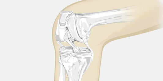 Dislocated Knee – The Complete Injury Guide