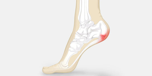 Heel Pain - The Complete Injury Guide