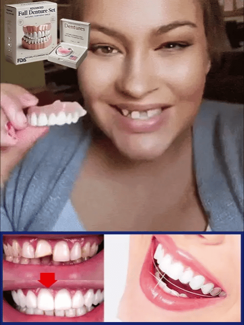 Flexible Denture Set for Upper & Lower Jaw – Reusable & Custom-Fit — photo 5