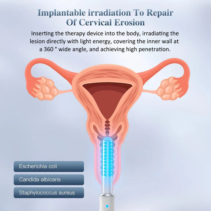 KTS® Portable Vaginal Rejuvenation Wand — photo 6