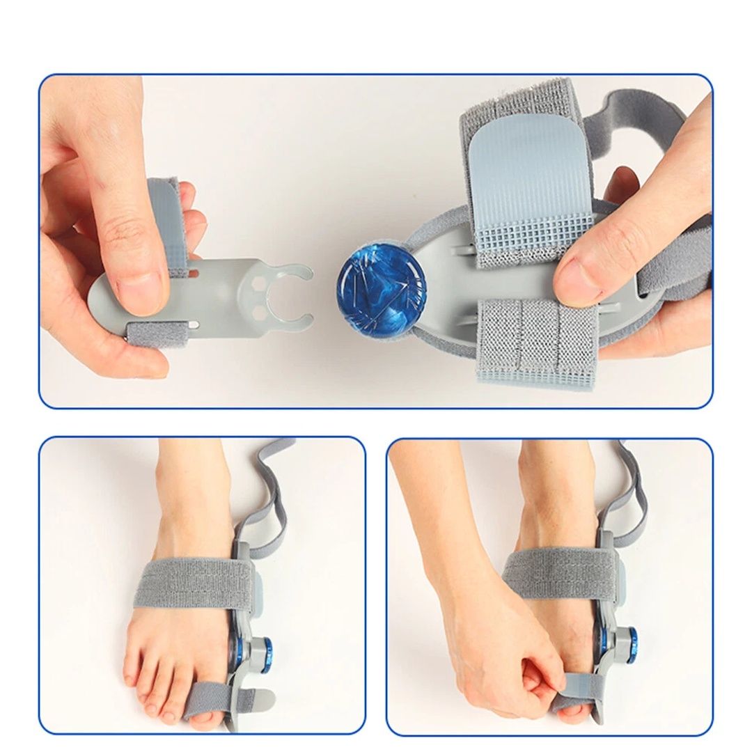 Bunion Fix Toe Valgus Corrector Big Toe Straightener — photo 6