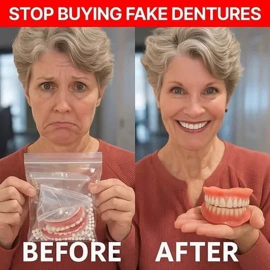 Removable Full Arch Denture Set with Flexible Cushion Grip for Everyday Wear — photo 10