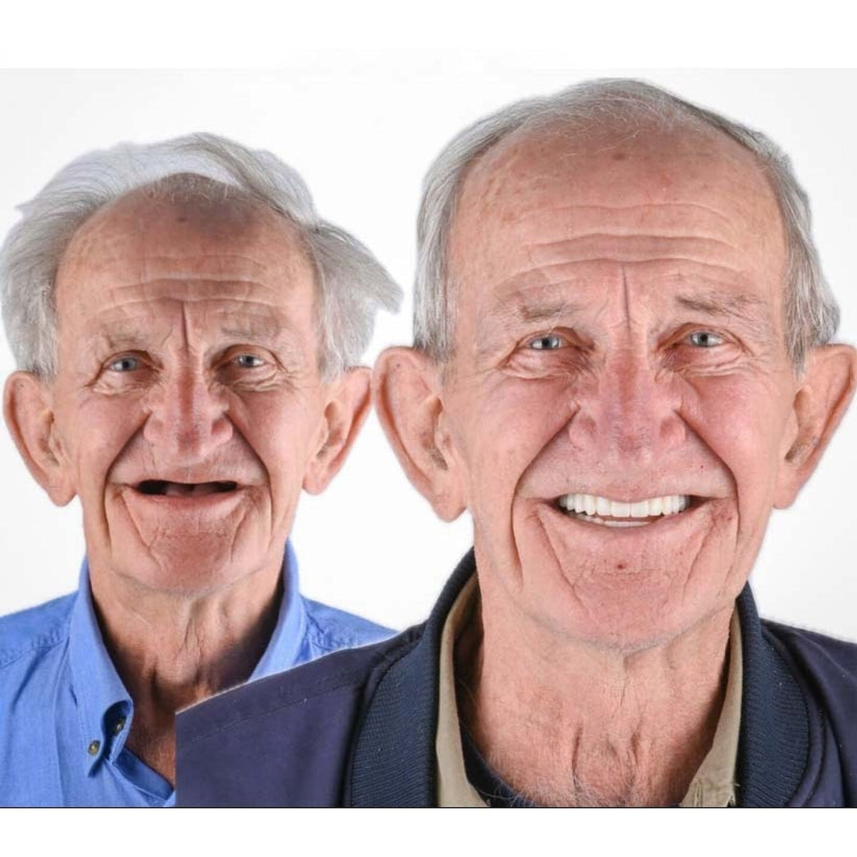 Removable Full Arch Denture Set with Flexible Cushion Grip for Everyday Wear — photo 6